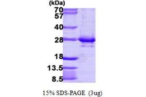 RAB14 Protein (AA 1-215) (His tag)