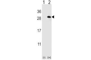 Western blot analysis of EIF4E2 antibody and 293 cell lysate (2 ug/lane) either nontransfected (Lane 1) or transiently transfected (2) with the EIF4E2 gene. (EIF4E2 antibody)