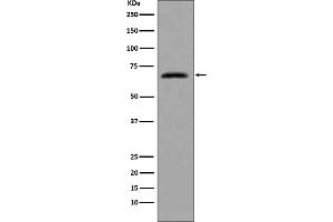 Western blot analysis of extracts from HeLa cells, using CDC7 antibody.