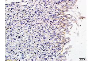 Formalin-fixed and paraffin embedded mouse small intestine labeled with Anti SLCO2B1 Polyclonal Antibody, Unconjugated (ABIN751048) followed by conjugation to the secondary antibody and DAB staining (SLCO2B1 antibody  (AA 531-630))
