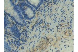 Detection of NRP1 in Human Rectum Tissue using Polyclonal Antibody to Neuropilin 1 (NRP1)