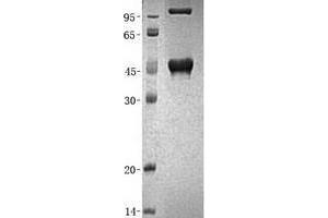 Validation with Western Blot (UPB1 Protein (His tag))