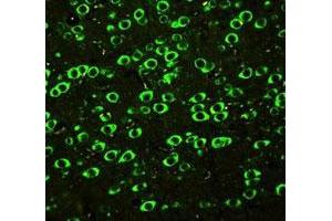 Immunofluorescence analysis of paraffin-embedded rat brain tissue sections, staining ABI1 in cytoplasm by SABC-FITC.