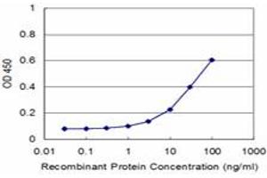 Detection limit for recombinant GST tagged TOPORS is approximately 3ng/ml as a capture antibody. (TOPORS antibody  (AA 98-205))