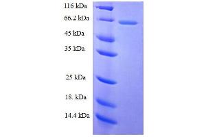 Lectin, Galactoside-Binding, Soluble, 3 Binding Protein (LGALS3BP) (AA 19-574) protein (His tag) expressed in E.