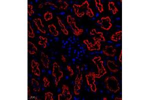 Immunofluorescence (Paraffin-embedded Sections) (IF (p)) image for anti-Cubilin (Intrinsic Factor-Cobalamin Receptor) (CUBN) antibody (ABIN7073601)