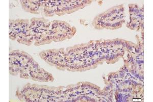 Formalin-fixed and paraffin embedded mouse intestine labeled with Anti-Rad51 Polyclonal Antibody, Unconjugated (ABIN1715101) at 1:200 followed by conjugation to the secondary antibody and DAB staining (RAD51 antibody  (AA 65-170))