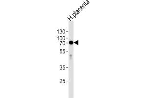 Western Blotting (WB) image for anti-Alkaline Phosphatase (ALP) antibody (ABIN2998256) (Alkaline Phosphatase antibody)