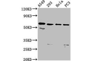 Western Blot Positive WB detected in: A549 whole cell lysate, 293 whole cell lysate, Hela whole cell lysate, PC-3 whole cell lysate All lanes: DDX28 antibody at 6. (DDX28 antibody  (AA 71-206))