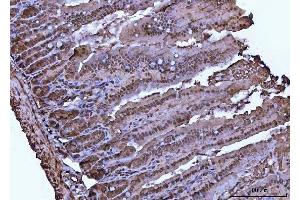 IHC analysis of VCP using anti-VCP antibody (ABIN7599605). (VCP antibody  (AA 10-512))