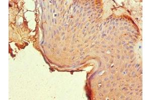 Immunohistochemistry of paraffin-embedded human skin tissue using ABIN7161902 at dilution of 1:100 (NR2C1 antibody  (AA 1-240))