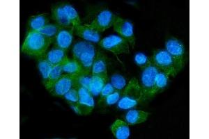 anti-Low Density Lipoprotein Receptor-Related Protein 8, Apolipoprotein E Receptor (LRP8) (AA 444-960) antibody
