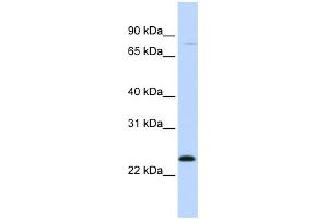 WB Suggested Anti-MX1 Antibody Titration: 0. (MX1 antibody  (C-Term))