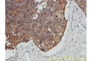 Image no. 2 for anti-Prefoldin Subunit 3 (PFDN3) (AA 1-198) antibody (ABIN466118) (VBP1 antibody  (AA 1-198))