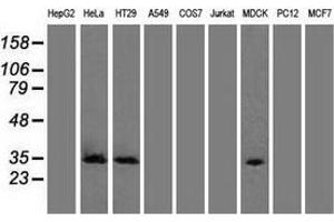 Western blot analysis of extracts (35 µg) from 9 different cell lines by using anti-CDK5 monoclonal antibody. (CDK5 antibody)