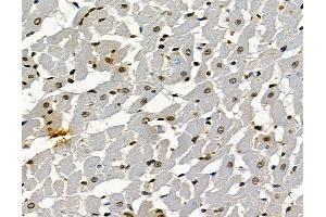 ABIN7097045 and ABIN7101112 at 1/100 staining rat heart tissue by IHC-P.