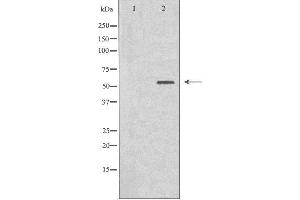 Western blot analysis of extracts from HT-29 cells, using Cytochrome P450 2B6 antibody.