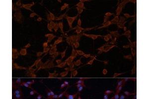 Immunofluorescence analysis of NIH/3T3 cells using P Glycoprotein Polyclonal Antibody at dilution of 1:100. (P-Glycoprotein antibody)