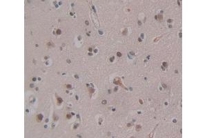 Used in DAB staining on fromalin fixed paraffin- embedded Kidney tissue (CHD5 antibody  (AA 712-896))