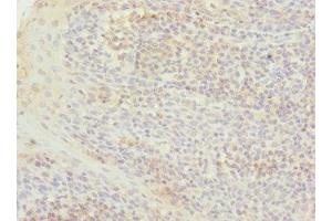 Immunohistochemistry of paraffin-embedded human tonsil tissue using ABIN7172039 at dilution of 1:100 (TXNL4B antibody  (AA 1-149))