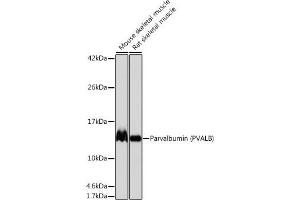 Western blot analysis of extracts of various cell lines, using Parvalbumin (PVALB) (PVALB) antibody (ABIN7269182) at 1:1000 dilution. (PVALB antibody)