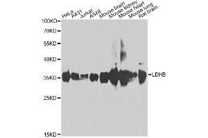 Western blot analysis of extracts of various cell lines, using LDHB antibody (ABIN2563654) at 1:1000 dilution. (LDHB antibody)