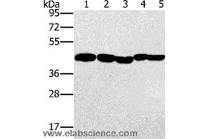 Western blot analysis of Hela, skov3 and A549 cell, mouse liver and human ovarian cancer tissue, using PON1 Polyclonal Antibody at dilution of 1:500 (PON1 antibody)