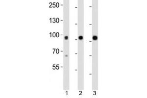 Western blot analysis of lysate from mouse 1) kidney, 2) lung and 3) skin tissue using Epha1 antibody at 1:1000.