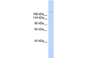 WB Suggested Anti-DYSF Antibody Titration:  0. (Dysferlin antibody  (N-Term))