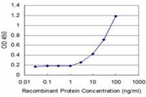 Detection limit for recombinant GST tagged FOSL2 is approximately 3ng/ml as a capture antibody. (FOSL2 antibody  (AA 207-296))