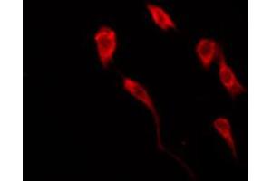 ABIN6267486 staining COS7 by IF/ICC. (IRS1 antibody  (pSer639))