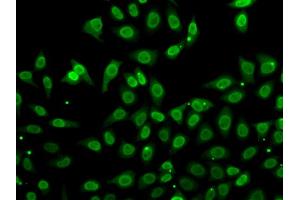 Immunofluorescence analysis of A549 cells using GCA antibody (ABIN5974261). (Grancalcin antibody)