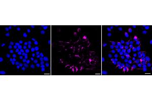 Immunocytochemical staining of HeLa cells with INA antibody (ABIN7799117), 1:1,000). (Recombinant INA antibody)