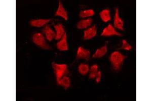 ABIN6267073 staining HeLa by IF/ICC. (CHEK1 antibody  (pSer280))