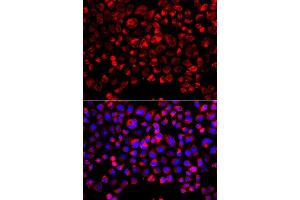 Immunofluorescence analysis of A549 cell using SULT1E1 antibody. (SULT1E1 antibody)