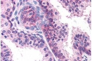 Anti-DHRS7 antibody  ABIN1048499 IHC staining of human prostate. (DHRS7 antibody  (Internal Region))