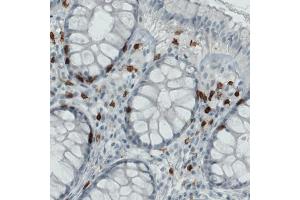 Immunohistochemical staining (Formalin-fixed paraffin-embedded sections) of human rectum with CD3E monoclonal antibody, clone CL1497  shows strong immunoreactivity in a subset of lymphoid cells. (CD3 epsilon antibody  (AA 25-126))