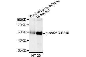 Western blot analysis of extracts of HT-29 cells, using Phospho-cdc25C-S216 antibody (ABIN5995616). (CDC25C antibody  (pSer216))