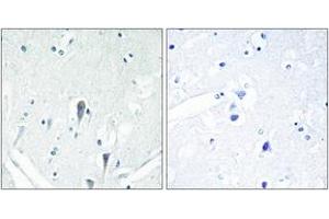 Immunohistochemistry analysis of paraffin-embedded human brain, using IRAK3 Antibody. (IRAK3 antibody  (AA 491-540))