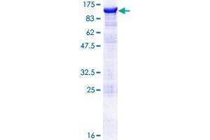 SSH3 Protein (AA 1-659) (GST tag)