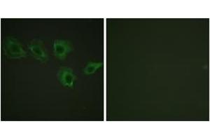 Immunofluorescence analysis of A549 cells, using MYPT1 (Phospho-Thr696) Antibody. (PPP1R12A antibody  (pThr696))