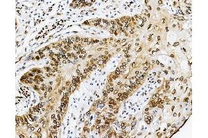 IHC analysis of Emerin using anti-Emerin antibody (ABIN4886569). (Emerin antibody  (N-Term))
