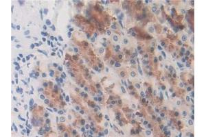 DAB staining on IHC-P; Samples: Rat Stomach Tissue (GSTK1 antibody  (AA 20-214))