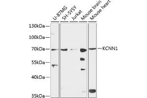 Western blot analysis of extracts of various cell lines, using KCNN1 antibody (ABIN6130514, ABIN6142765, ABIN6142767 and ABIN6224976) at 1:3000 dilution. (KCNN1 antibody  (AA 1-90))