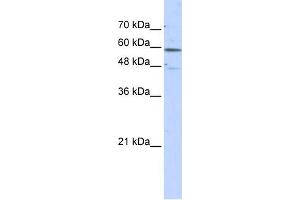 WB Suggested Anti-GLUD2 Antibody Titration: 0. (GLUD2 antibody  (N-Term))