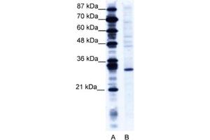Western Blotting (WB) image for anti-Ring Finger Protein 141 (RNF141) antibody (ABIN2460986)
