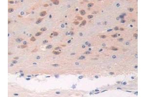 Detection of BRCA2 in Mouse Brain Tissue using Polyclonal Antibody to Breast Cancer Susceptibility Protein 2 (BRCA2) (BRCA2 antibody  (AA 2990-3232))