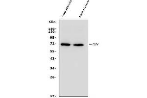 Western blot analysis of ALPP using anti-ALPP antibody (ABIN4886453). (PLAP antibody  (C-Term))