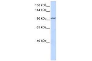 Image no. 1 for anti-Zinc Finger Protein 280D (ZNF280D) (AA 540-589) antibody (ABIN6740450) (ZNF280D antibody  (AA 540-589))