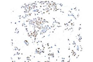 Immunocytochemistry (ICC) image for anti-CCCTC-Binding Factor (Zinc Finger Protein) (CTCF) (AA 650-700) antibody (ABIN7453967)